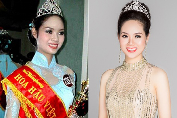 Hoa hậu Mai Phương cải thiện nhiều về nhan sắc từ sau khi đăng quang năm 2002. Việc thực hiện chỉnh sửa hàm răng giúp người đẹp Hải Phòng có nụ cười càng thêm tươi rói.