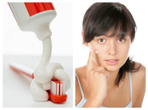 ​​​​​​​Sử dụng kem đánh răng trị mụn một thời gian dài sẽ dễ làm làn da trở nên yếu và dễ kích ứng.